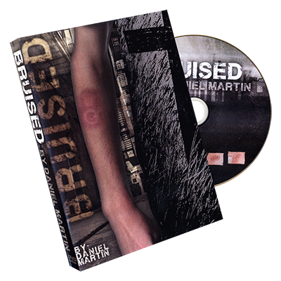Bruised | Daniel Martin